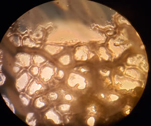 Slime mold mounted and observed under the microscope.