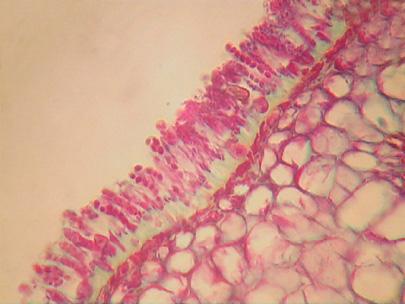 Higher magnification showing the asci produced by Taphrina on the surface of an infected peach leaf. There are 8 ascospores in each ascus but the ascospores can bud and divide producing many spores. No fruiting body or ascocarp is produced. 