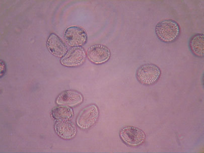 Another microscopic view of aeciospores. Note rounded projections on spores.