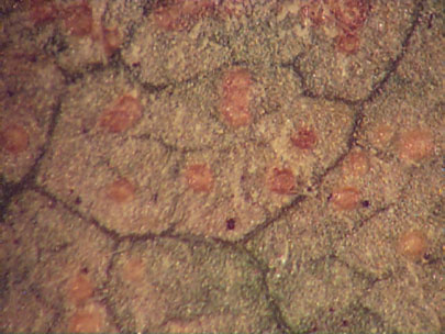 Another view of the uredinia produced on the lower surface of infected leaves.