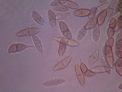 The teliospores of Gymnosporangium are two celled.