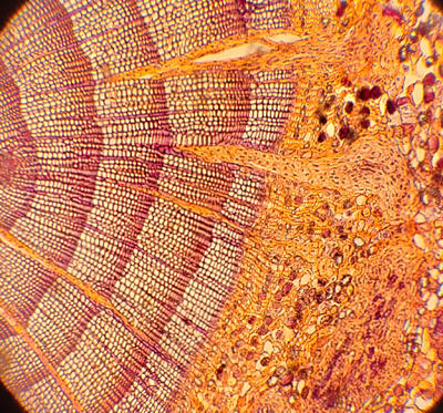 Cortical strands and sinkers (yellow cells) of dwarf mistletoe in cross section of conifer branch as seen under the microscope. 