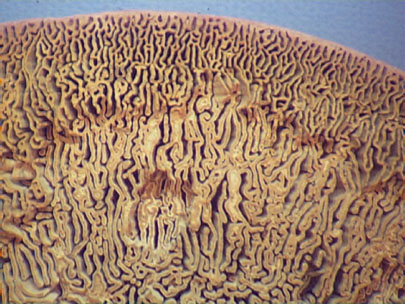 A higher magnification showing the stretched pores.