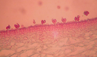 A higher magnification of a gill and basidiospores produced on basidia.