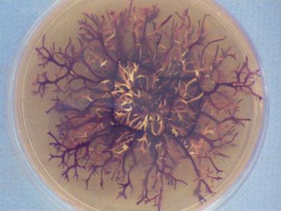 Culture of Armillaria showing rhizomorphs growing in the culture media.
