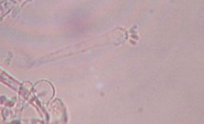 Asexual spores.The asexual form has been named Spiniger (old name Oedocephalum).