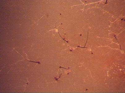 Synnemata produced by a blue stain fungus as seen with a hand lens.