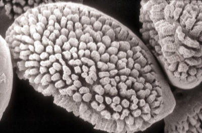 A scanning electron micrograph showing the warty appearance (rounded projections on the spore) of an aeciospore