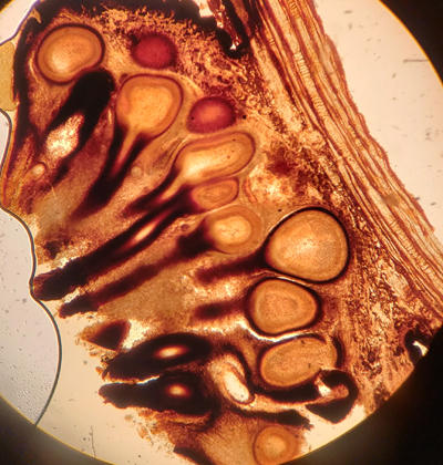 A cross section of a group of perithecia in stroma. You can see the round bases of the perithecia and their long necks. Only the tips of the perithecia can be seen on the cankers
