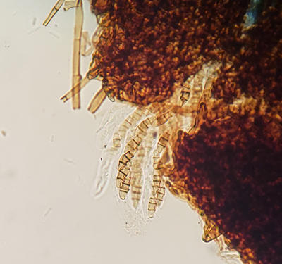 Asci and ascospores (4-celled) of Herpotricia. A brown felt snow mold that grows on firs.