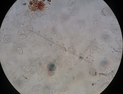 Aeciospores viewed with a microscope. Aeciospores have rough warty projections.