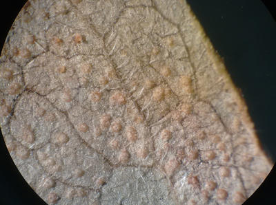 Uredinia (yellowish areas) produce urediniospores.