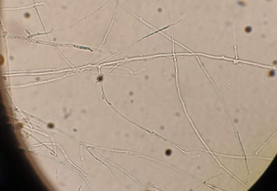 Mycelium of a wood decay fungus. Hyphae can be seen with clamp connections which look like small bumps on the hyphae.