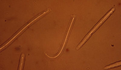 When mature and released from the hysterothecia, the long thin ascospores have a sticky sheath that helps them adhere to needles.
