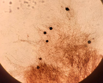Microsclerotia (dark round structures in micrograph) are formed by the fungus.
