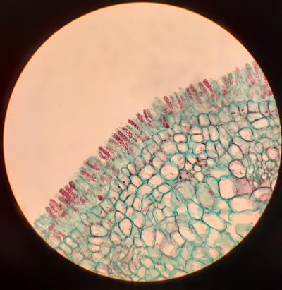 A section of an infected leaf surface showing the naked asci produced by Taphrina.
