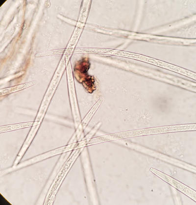 Higher magnification of pine wood nematode Bursaphelenchus xylophilus.