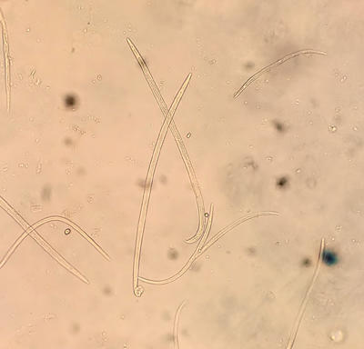 Nematodes are minute round worms. These pine wood nematodes were extracted out of pine wood.