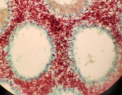 A section of a fruiting body with pores. The basidia (green), red is the mycelium between pores. The top left pore shows some basidiospores attached to basdidia.