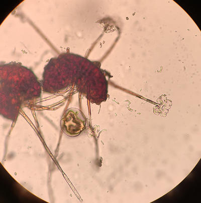 A cleistothecia with one acus that was broken out of it (round structure at bottom - you cannot see the ascospores in it but when mature it would have 8 ascospores inside). 