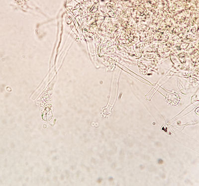 Another view of the conidiophores with spores detached.