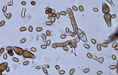 Teliospores producing basidia and basidiospores. You can see the two celled teliospores, basidia coming out of a teliospore and lots of small oblong basidiospores.