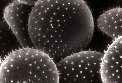 Scanning electron micrograph of urediniospores showing pointed projections on the spores.