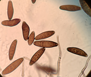 Cochliobolus spores