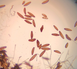 Cochliobolus spores